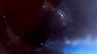 test tube cock endoscope POV urethral insertion ball rod